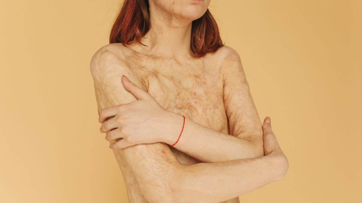 Cilt Barajı (Skin Barrier) Bozulması Nasıl Anlaşılır ve Nasıl Onarılır?