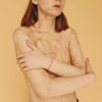 Cilt Barajı (Skin Barrier) Bozulması Nasıl Anlaşılır ve Nasıl Onarılır?